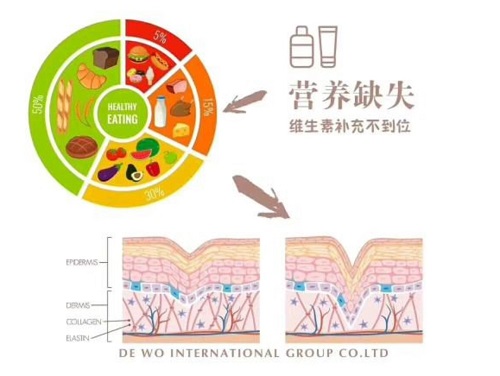 皮膚干燥怎么辦？膠原蛋白的流失是罪魁禍首