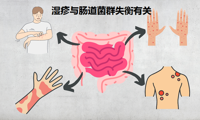 濕疹來報到 問題在腸道 擺脫濕疹試試這招